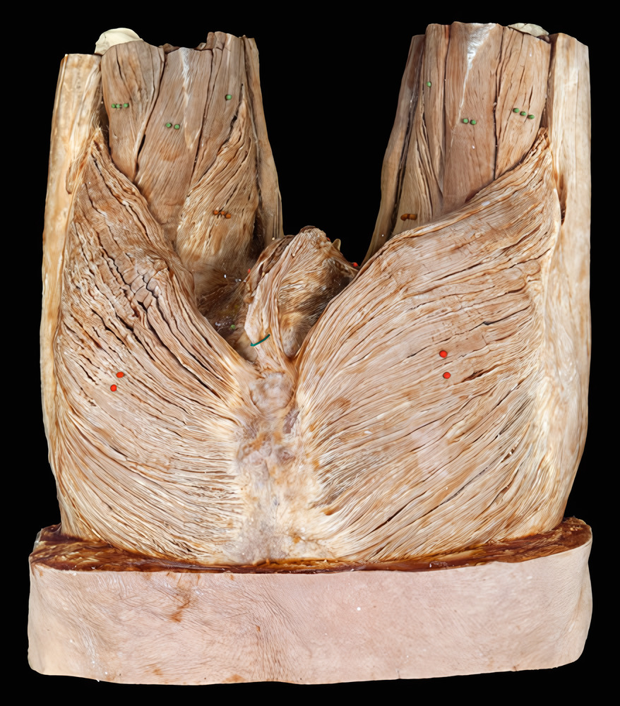 Dem-212 – Anatomionline.dk