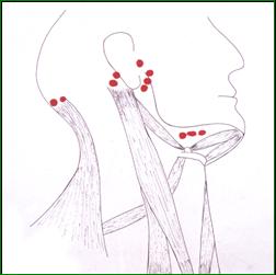 Hals lymfekirtler TrÃ¦ningsprogram